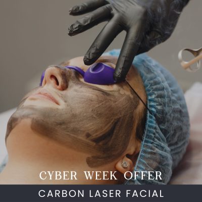 Online Carbon Laser Facial Treatment Course