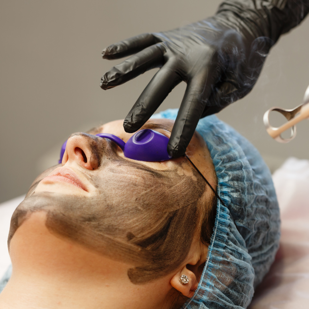 Online Carbon Laser Facial Treatment Course The Online Beauty Courses