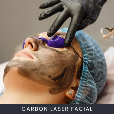 Online Carbon Laser Facial Treatment Course