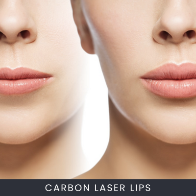 Online Carbon Laser Lip Plumping Course