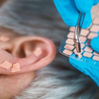 Ear Seeding Auricular Therapy Course