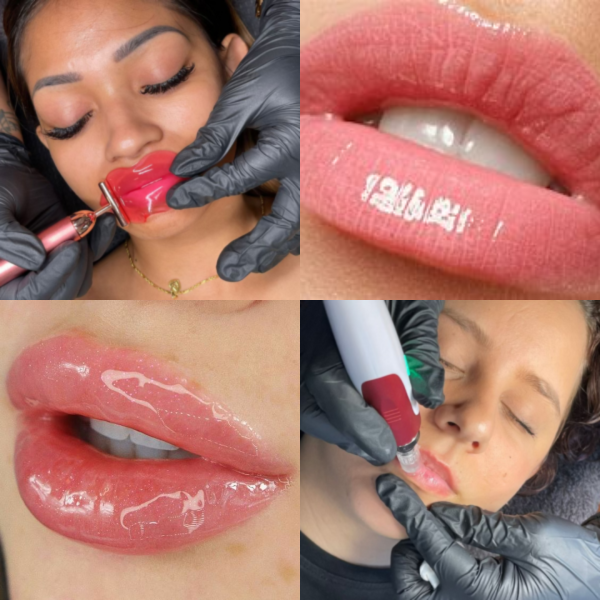 Hydra Gloss Lips